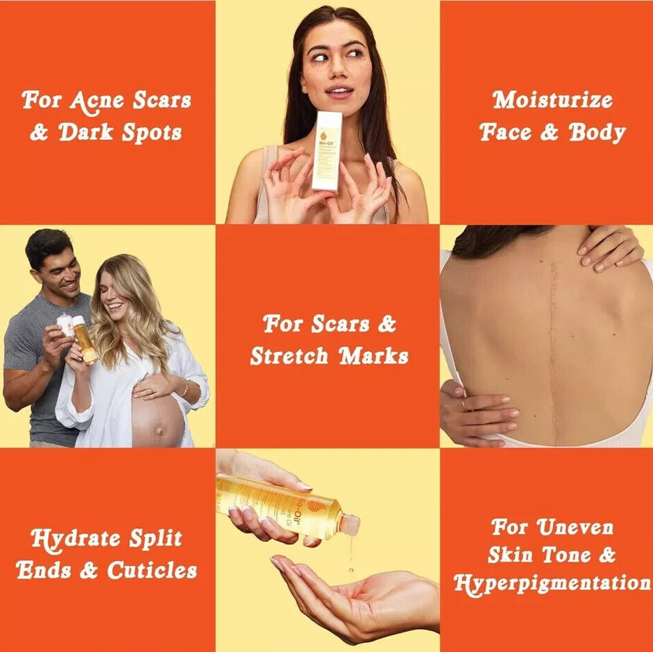 3 Pack Bio-Oil Skincare Body Oil Moisturizer Scars & Stretch Marks 0.85oz Each