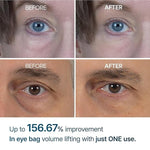 Dr.Melaxin Eyephalt Eyecream for Eyebags Puffiness Wrinkles 10ml  Exp.Date 03/28