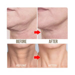 Gold Neck Mask Anti-Wrinkle Firm Anti Aging Necks Skin Care 10pcs box Exp 07/28